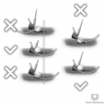 What causes topped shots? - Bottom of the swing arc too soon or too late, or too high